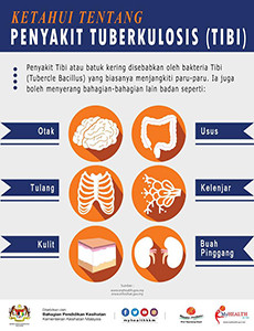 Ketahui Tentang Penyakit Tuberkulosis (TIBI)